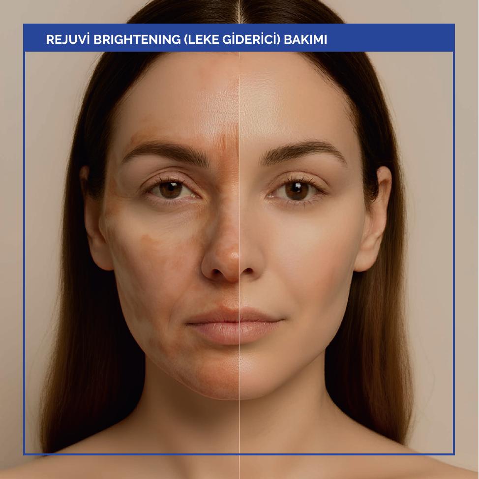 Brightening Leke Görünümü Bakımı